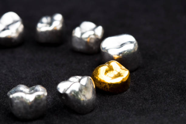 Zahngold verkaufen